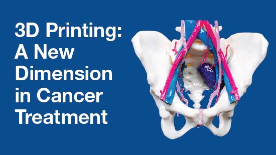 Infographic image for 3D printing for cancer treatment