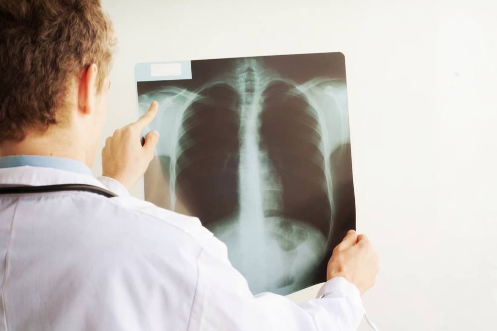 physician looking at chest x-ray