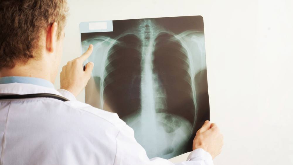 Un médico mira una radiografía