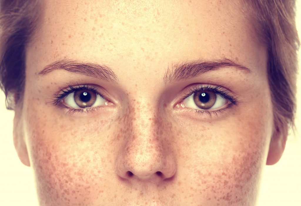 a close-up of the eyes, cheeks and nose of a young woman with freckles
