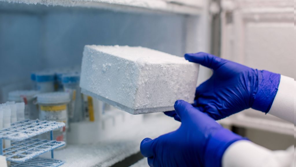Un tecnólogo saca del congelador del laboratorio las muestras congeladas