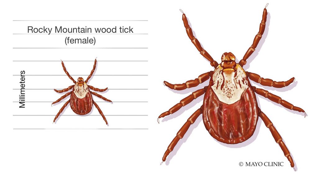 Illustration of a Rocky Mountain wood tick