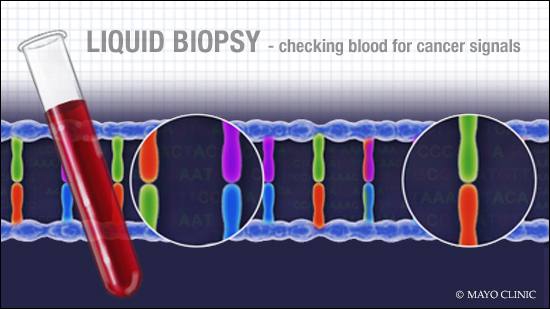 Ilustración médica de un tubo de ensayo con sangre y un filamento de ADN que representa el concepto de la biopsia líquida para cáncer