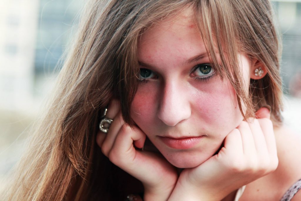 a close-up of a teenage girl with acne on her forehead, with her chin resting in her hands, looking sad