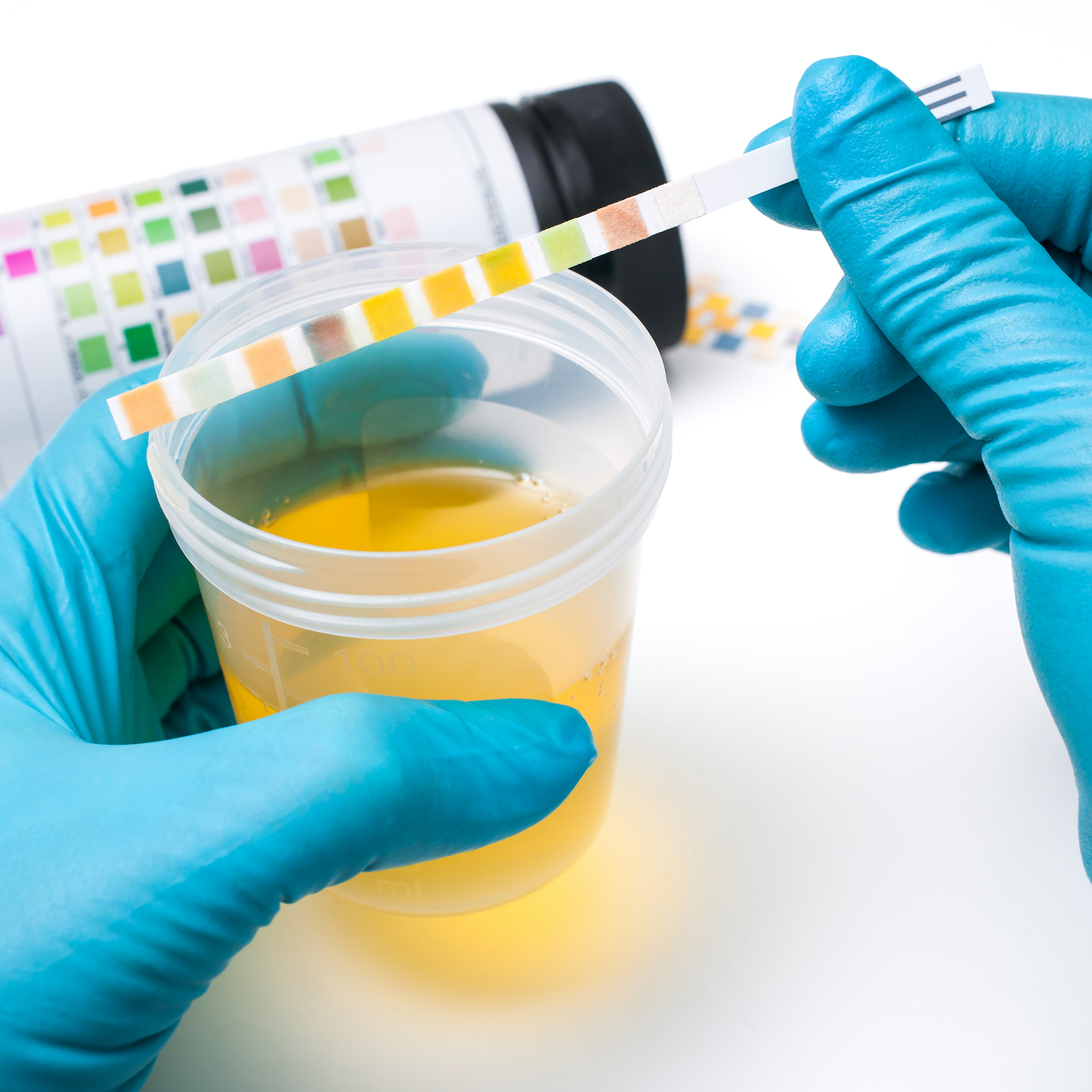 Medical report and urine test strips