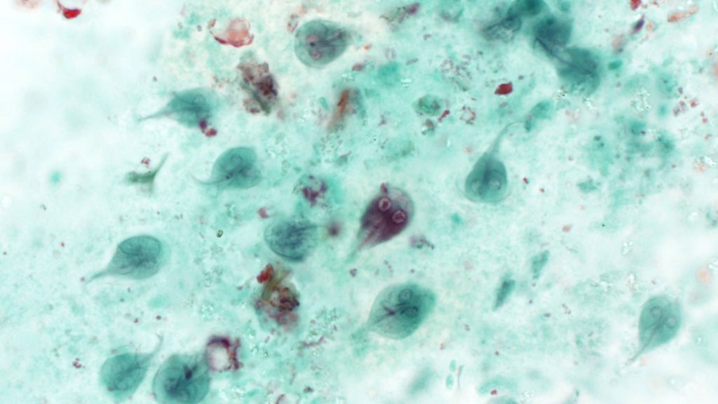 Microscopic view of Giardia parasites
