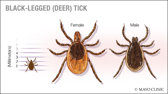 a medical illustration of black-legged (deer) ticks