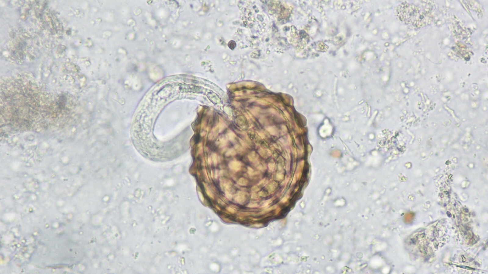 Ascaris egg as seen by a microscope, hatching to release an immature worm. Image courtesy of Emily Fernholz, MT(ASCP), Mayo Clinic