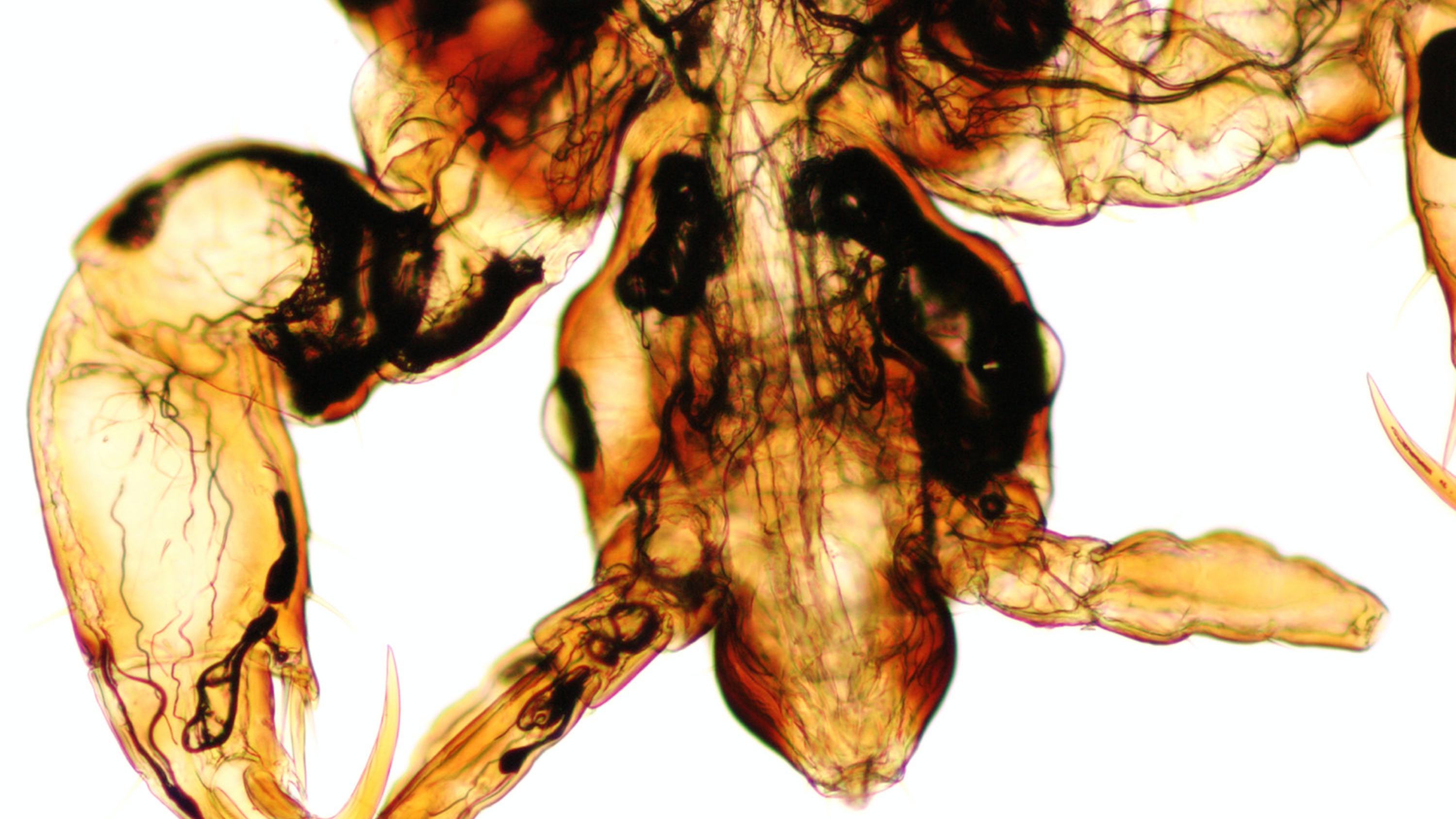 microscopic view of a head louse