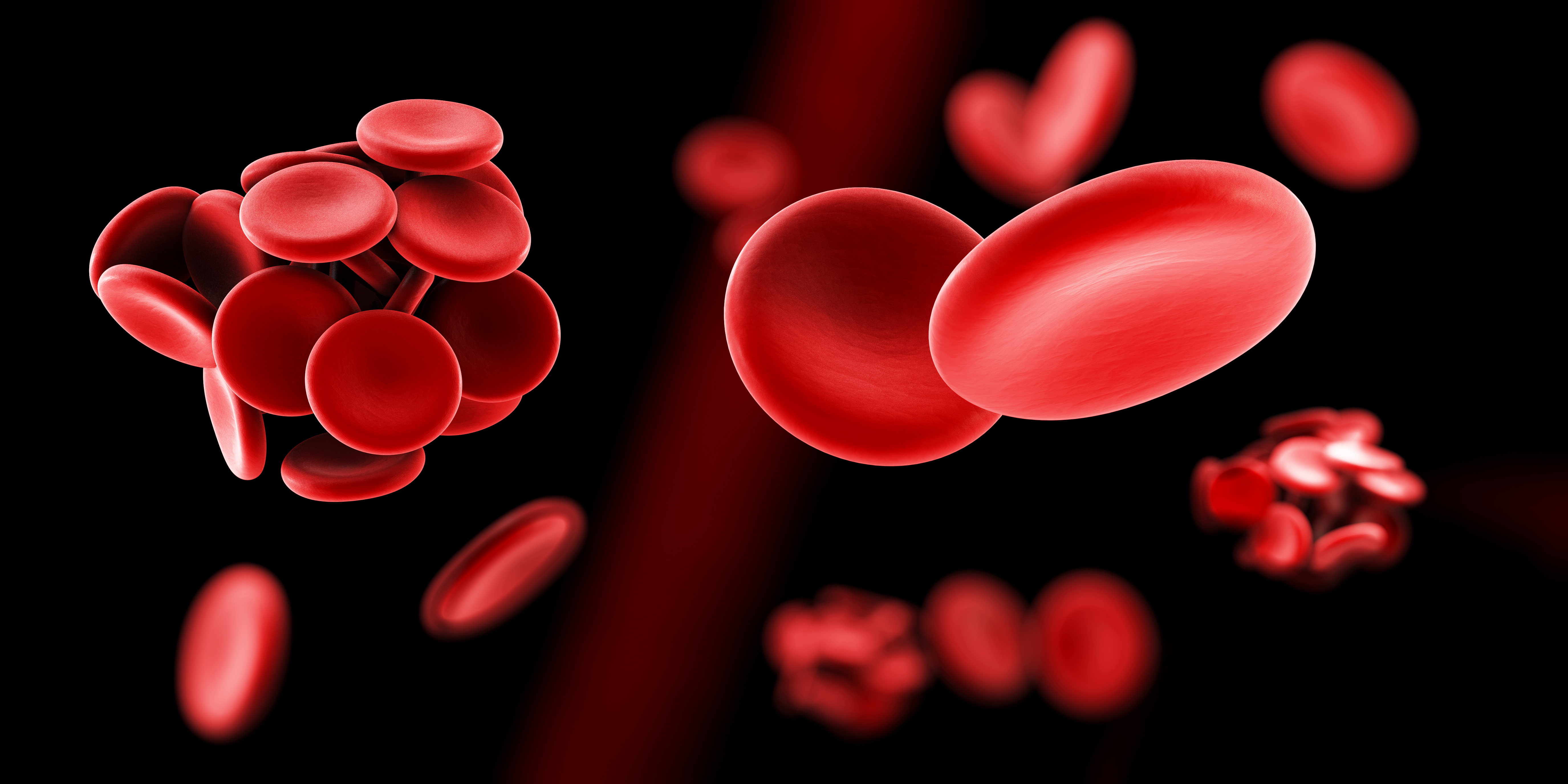 3D illustration of a blood clot and thrombosis