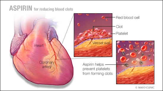 Ilustración médica de cómo la aspirina reduce el riesgo de coágulos sanguíneos