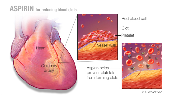 Mayo Clinic Q and A: Coated aspirin may not be as effective at reducing  blood clot risk - Mayo Clinic News Network