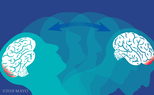 illustrated graphic of a person's head and brain with concussion injury at the front and the back of the head