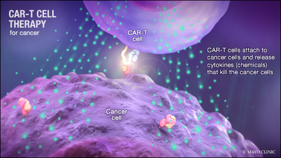 Ilustración médica de la terapia oncológica de células T con receptor de antígeno quimérico.