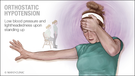 a medical illustration of orthostatic hypotension
