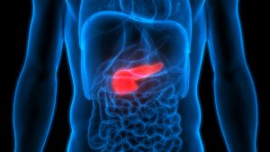 How a pancreas transplant can cure diabetes - Mayo Clinic News Network