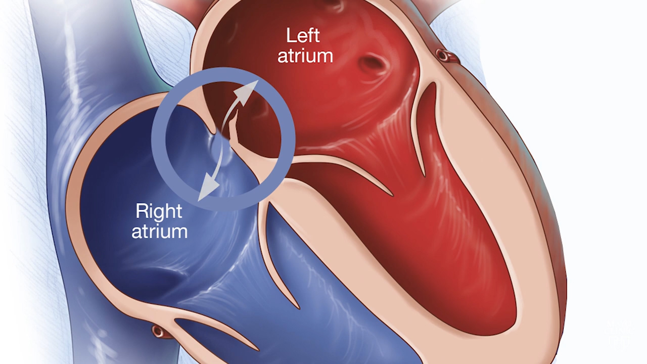 foramen ovale