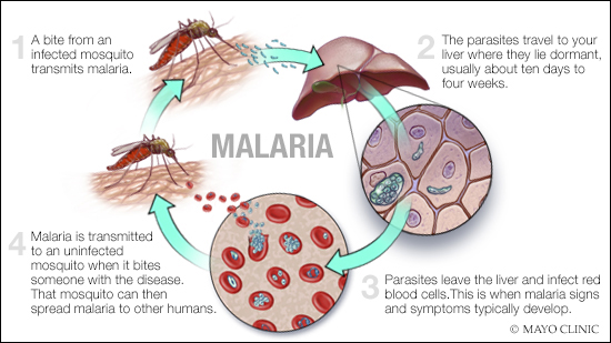 symptoms of malaria fever