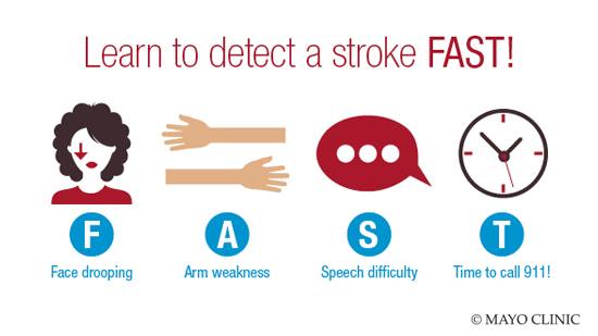 FAST acronym for detecting a stroke
