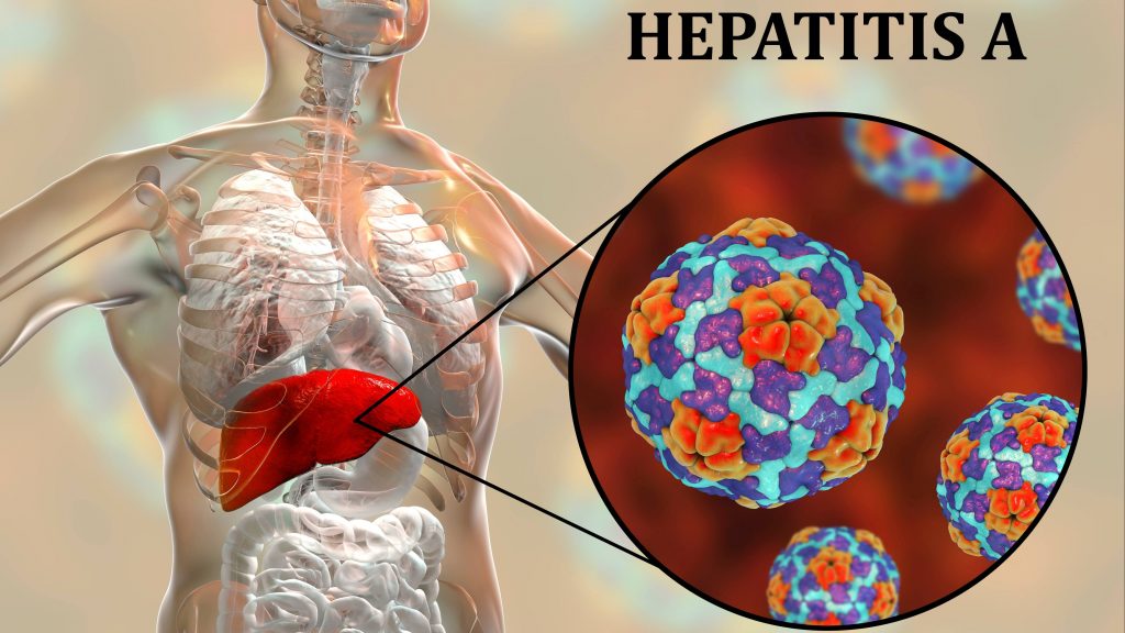 graphic of internal organs, highlighting the liver and highlighting Hepatitis A