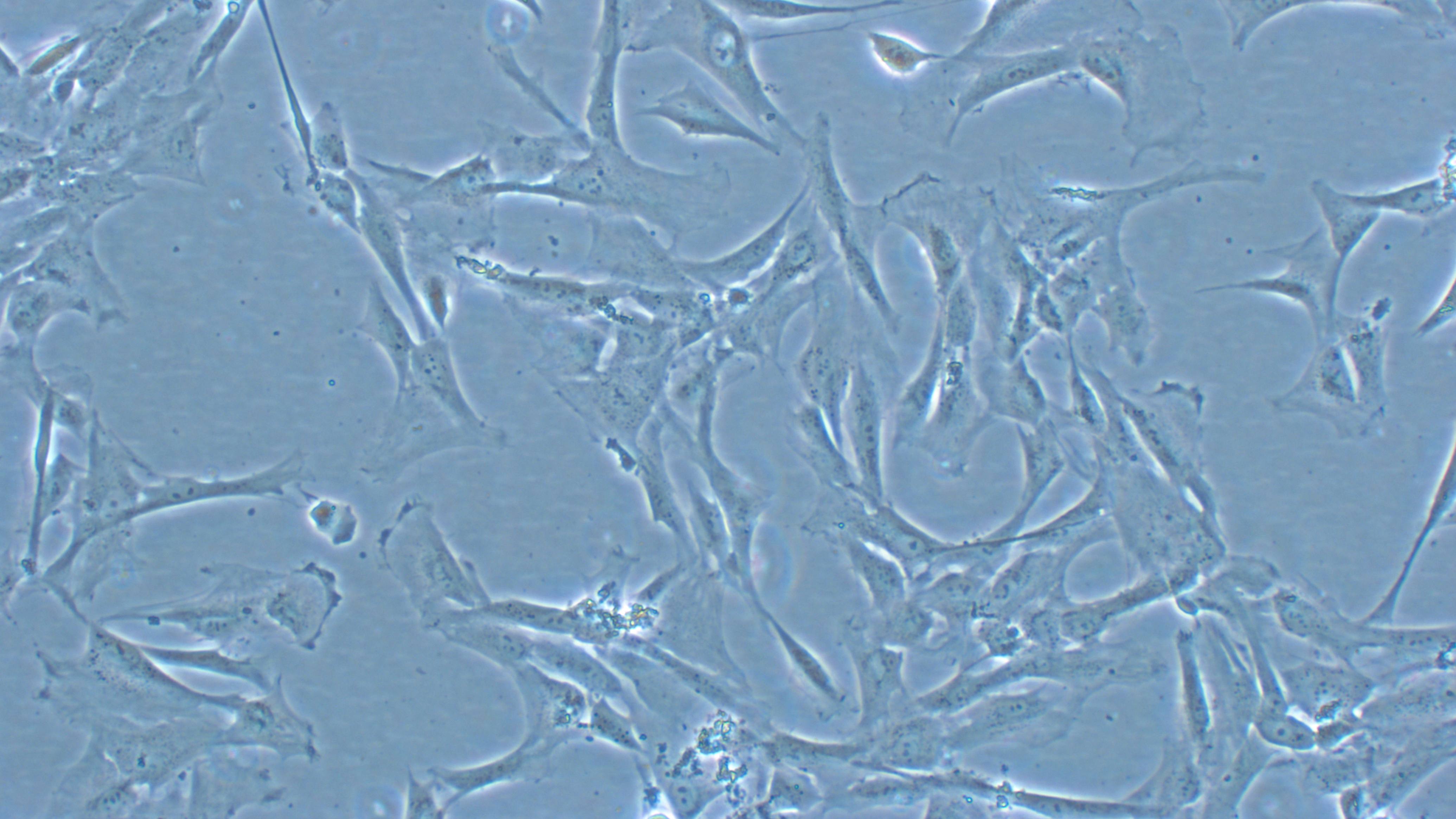 liver mesenchymal stromal cells under a microscope