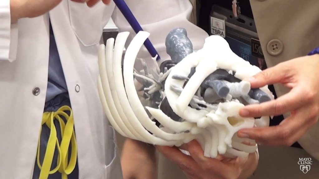 medical staff and surgeons holding a 3D printed model of a human lungs and rib cage