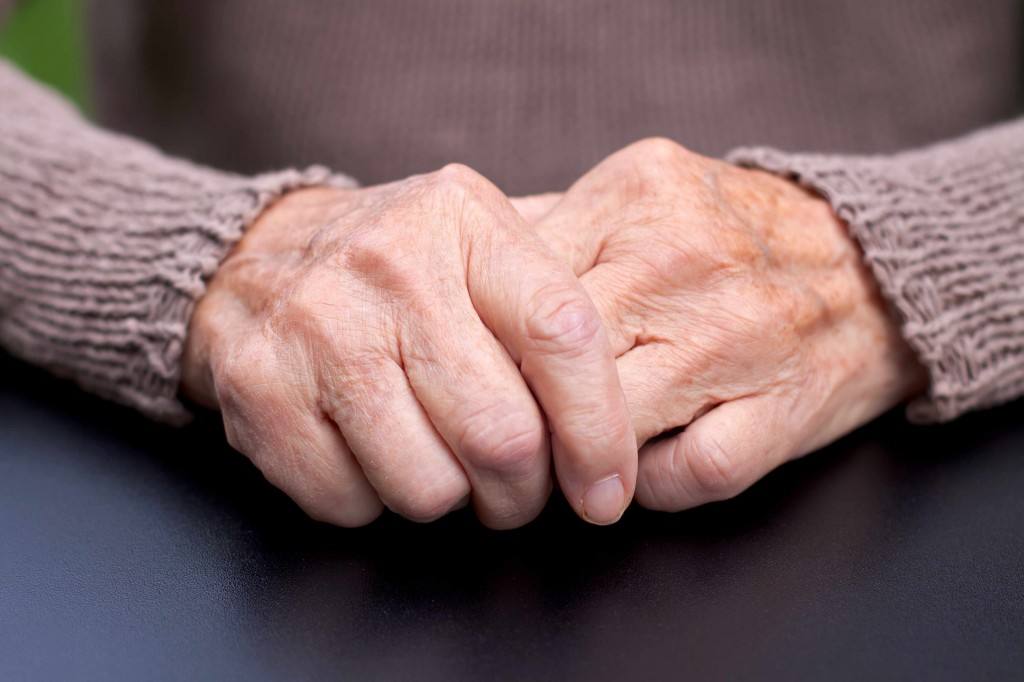 older adult hands showing arthritis