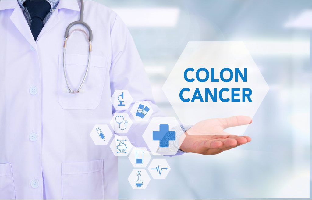 a medical staff person in a white lab coat holding a 3-D medical image graphic in his hand with the words colon cancer on the screen