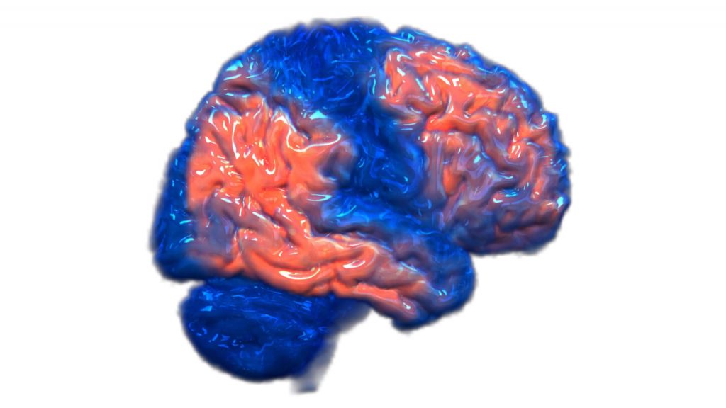 Imagen gráfica en 3D de un cerebro con colores azul y naranja que representan partes del cerebro afectadas por la enfermedad de Alzheimer