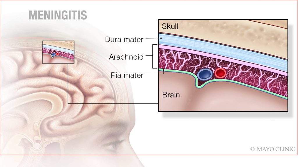 can humans get meningitis from dogs