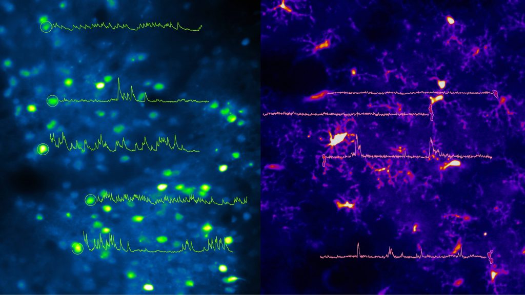 Mouse neuron activity