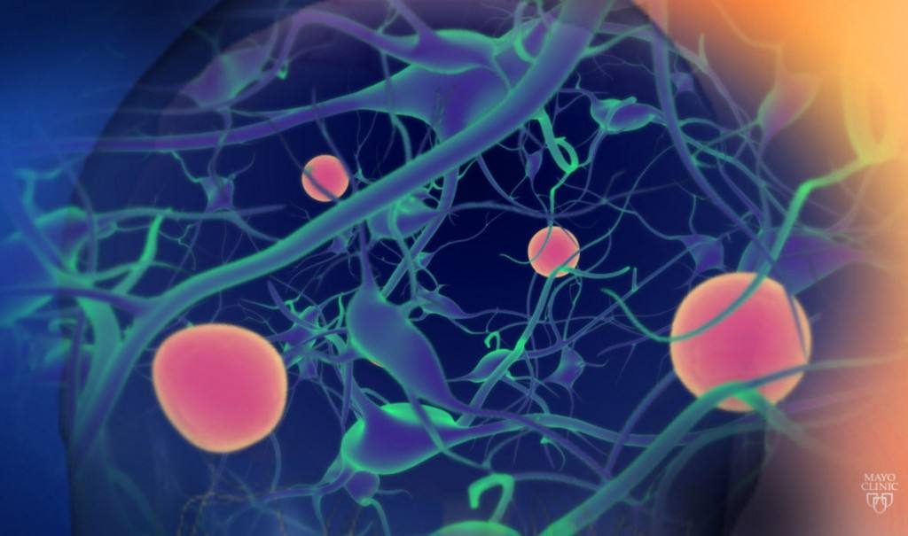 medical illustration of neurons related to ALS-neurons