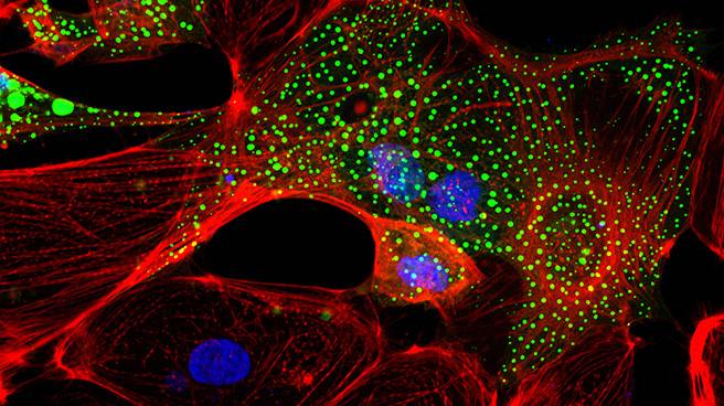 Pictured here are human cardiomyocytes (red) with the cell nuclei (blue) and granules (green).