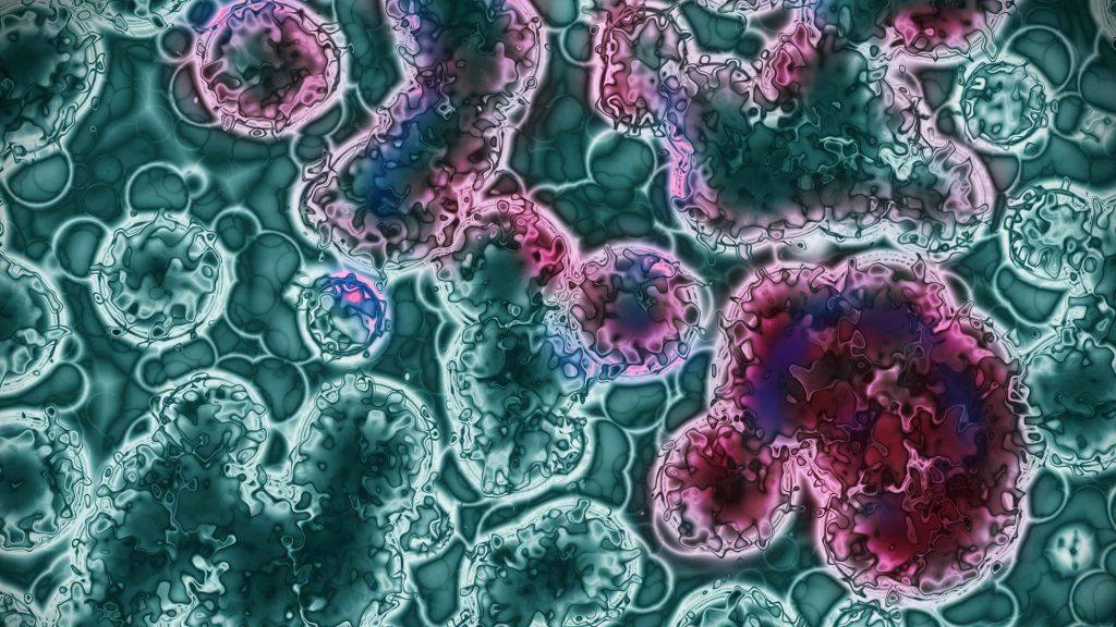 microscopic image of leukemia cells