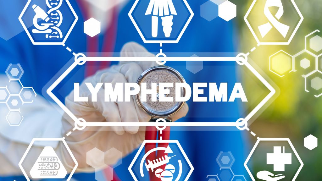 word graphic with medical icons and symbols surrounding the word LYMPHEDEMA