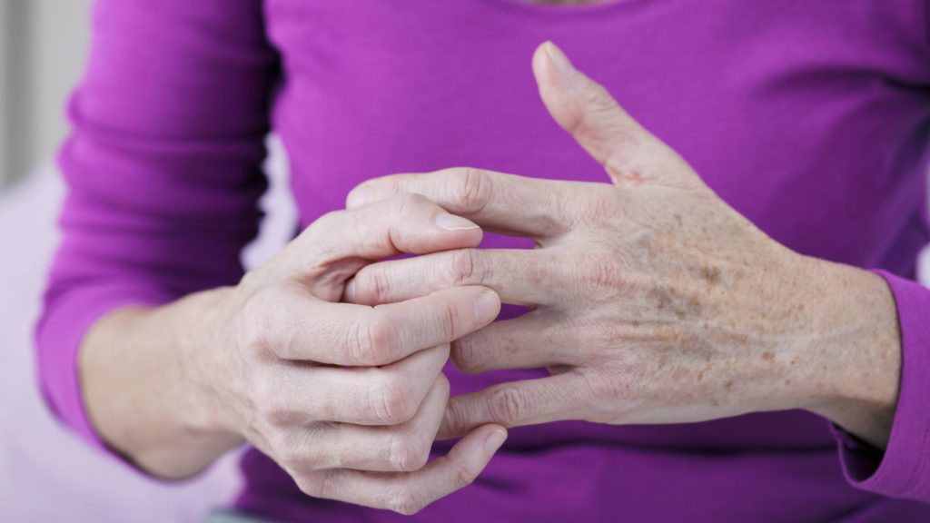close up of a middle aged white woman's hands as she rubs her fingers and joints that look painful with arthritis