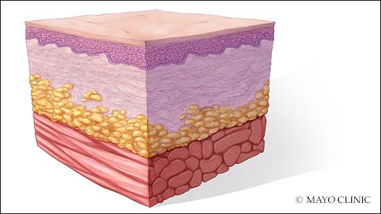 Ilustración médica de capas de la piel