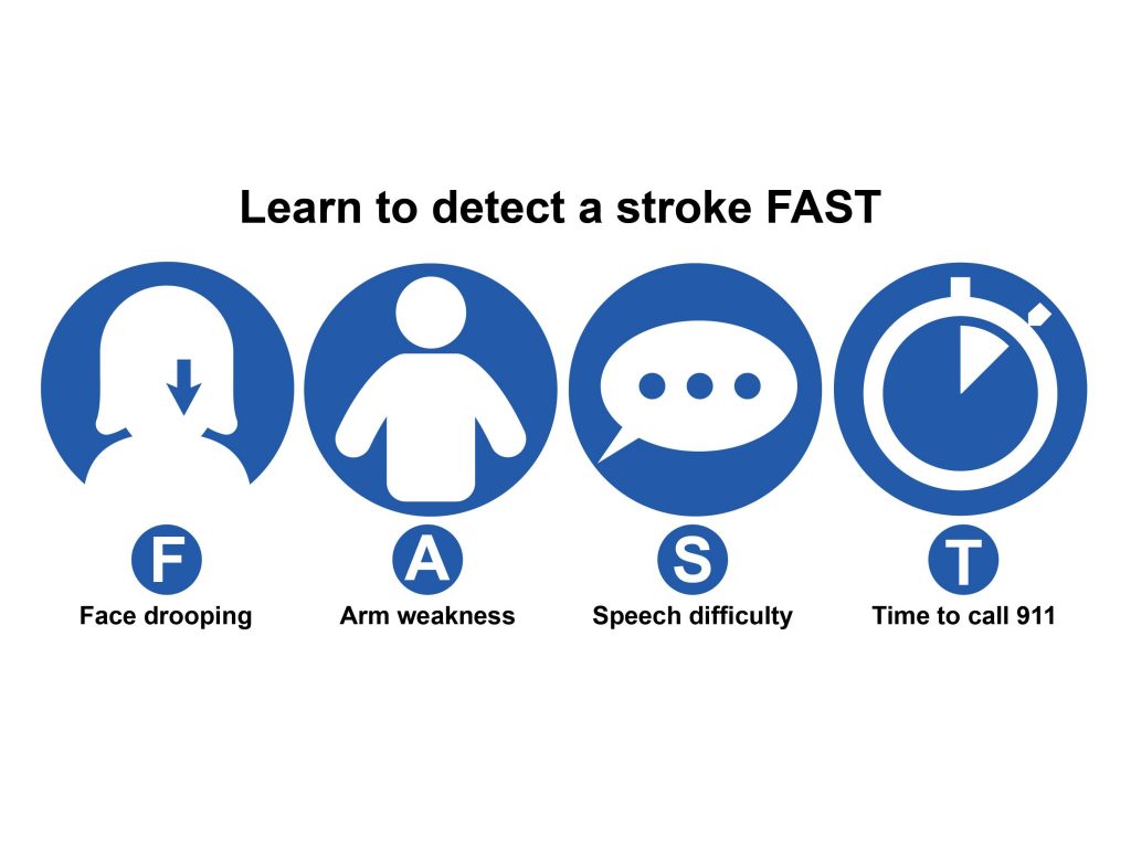 Learn to detect a stroke FAST, graphic