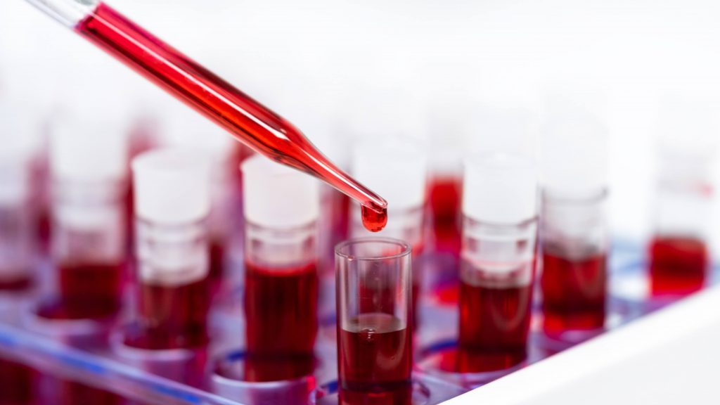 blood research with samples in several laboratory tubes