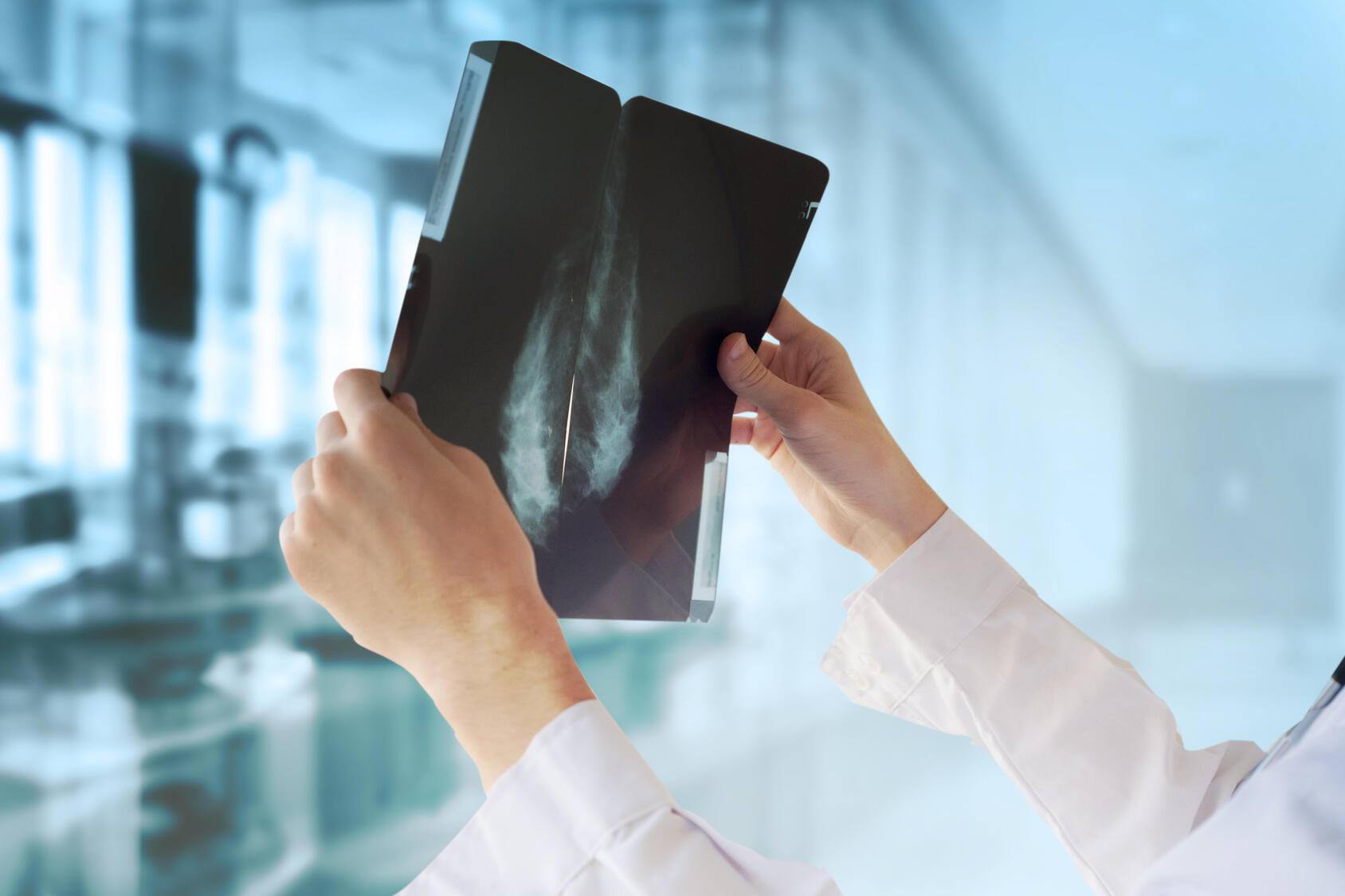 Women's Wellness: Molecular breast imaging - Mayo Clinic News Network