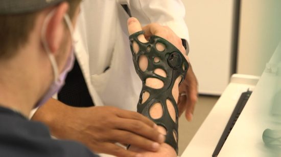 This 3D printed cast could be the future of healing broken bones