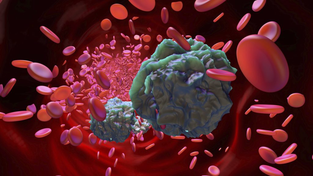 Ilustración de células de la leucemia