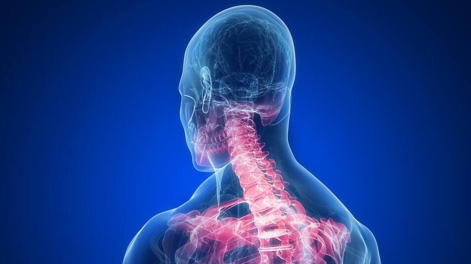 Mayo Clinic Q and A: Nonsurgical treatments may decrease pain from spinal  stenosis - Mayo Clinic News Network