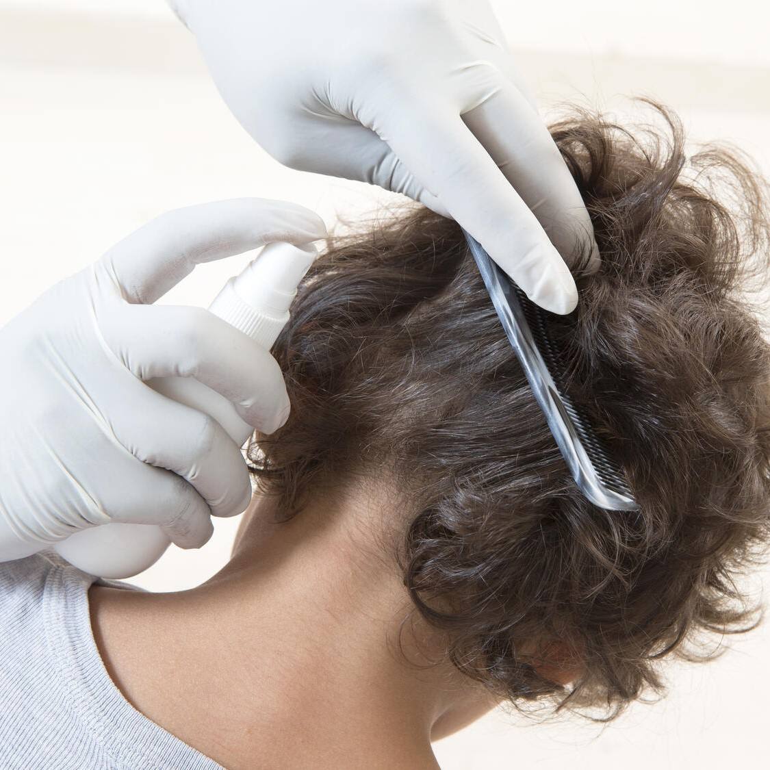 Осмотр и обработка педикулеза. Обработка волосистой части головы. Стрижка волос при педикулезе. Обработать волосы пациента.