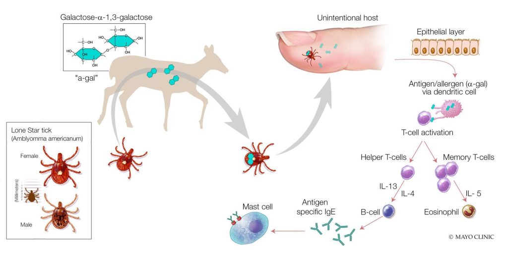 Mayo Clinic medical illustration showing how the lone star tick that has picked up a protein/antigen from a deer and transmitted it to a human. After the tick bite to the human, a standard IgE allergy sensitization reaction occurs.