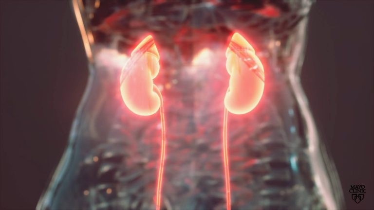 Kidney visual data 2