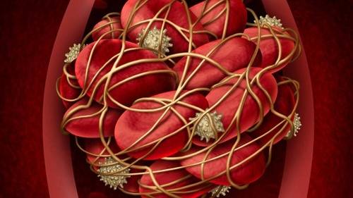 Science Saturday: Collaborative study discovers new disease behind patient’s recurring blood clots featured image