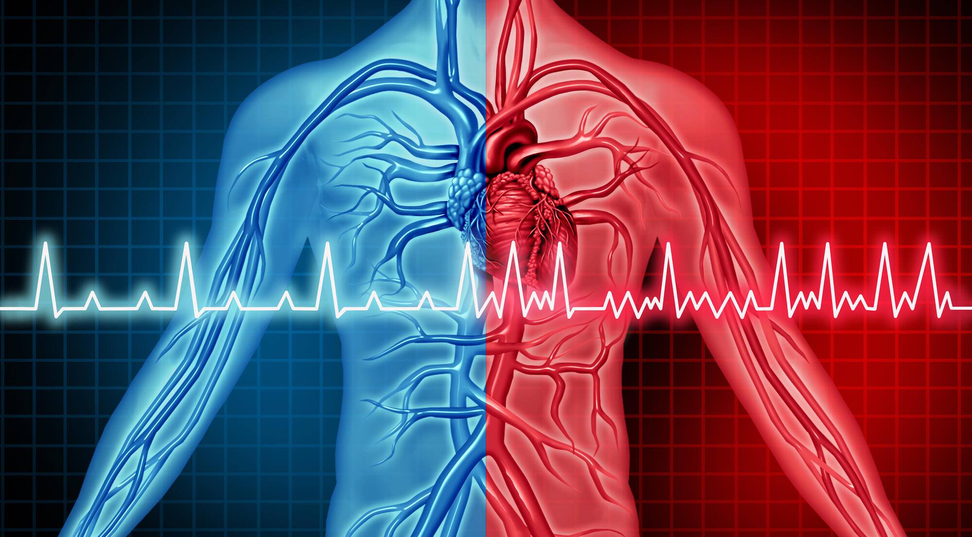 Mayo Clinic Q And A: What Is Cardiac Arrest? - Mayo Clinic News Network