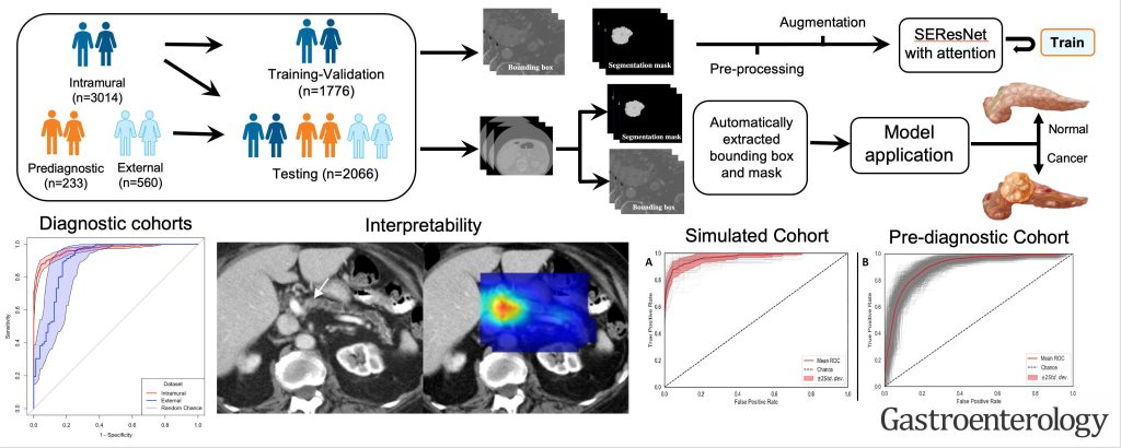 Mayo Clinic's AI innovation inspires hope in early detection of pancreatic  cancer - Mayo Clinic News Network