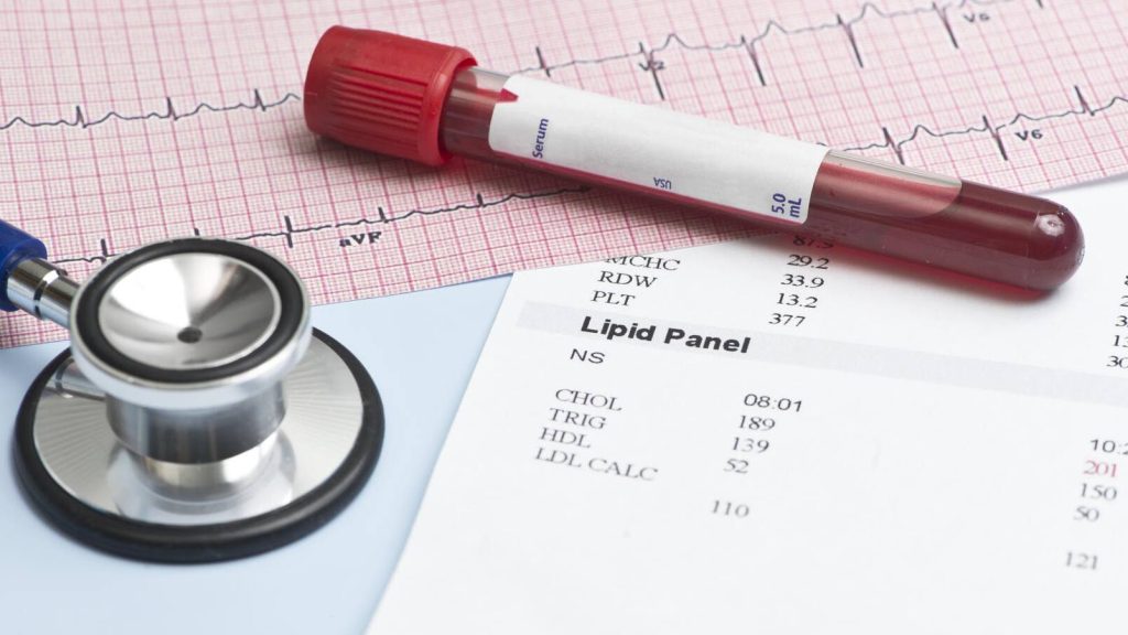 A lipid panel, also known as a complete cholesterol test, is a blood test that assesses the levels of cholesterol and triglycerides in the bloodstream.